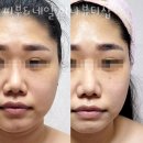 석남고가사거리(42145) | 청라네일샵 피부&amp;네일 미나뷰티샵 페디큐어디자인