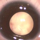 젊은눈안과의원 이미지