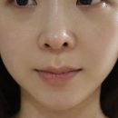 다이써바 | 비반콴트망카 로션 성분 효과, 붉은기·건조·트러블 피부에 2년 써본 내돈내산 후기