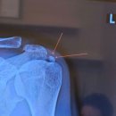 강동뼈선생정형외과의원 | 강동뼈선생정형외과 건강복지서비스인증 획득