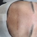 보임플래닝