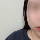 고촌읍 신곡리 532-65 | 김포 피부과 김포 365한의원 스킨앤라인클리닉에서 이중턱 박살내고 온 후기