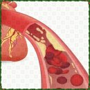 리바이브 PT 이미지