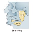 유행성 이하선염(Mumps) 이미지