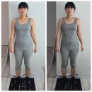 김인한의원 | 울산 삼산동 에스테틱 도깨비언니 승모근 어깨 관리