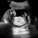 청담마리산부인과의원 이미지