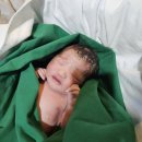 장유산부인과의원 | 장유산부인과 제왕절개 출산 1인실 수술비 후기