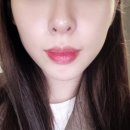 올리지오 앤봄의원 ㄹㅇ후기