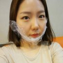 크라이오셀(Cryocell) | 분당 리얼미에서 엘란쎄와 브이라인 주사로 신부관리하구 왔어요 ♡