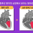 ■프랑스가 월드컵 우승한 날…심근경색 사망 ‘충격적 반전’[﻿불로장생의 꿈:바이오혁명]23회 이미지