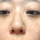 송송약국 | 세비타비 겔 6개월 사용 후기 | 모공 관리, 약국템 추천
