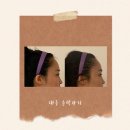 예등 | 대구 윤곽관리 달서구 슬리밍케어 보니예 에스테틱 후기