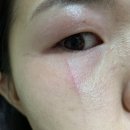 먹구름 뒤편에는 햇빛이 있어