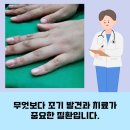 류마참내과의원 | [부산,경남] 류마티스내과 추천 믿고 맡길 전문의 찾기