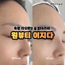 4123 | 홍성 내포 피부관리 원뷰티 이지다 숨결클렌징 후기 건조피부 개선