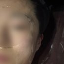 케어하우스 | 포항 남구 에스테틱 추천, 레이저 엑스터 관리 찐후기 얼굴 윤곽 관리 잘하는 소울테라피