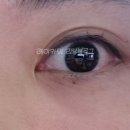 티아이스킨 네이버블로그