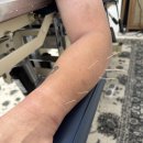 [W166] 카이로프랙틱 치료 및 침 치료 Dry Needling | Alignlab Chiropractic 이미지