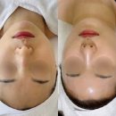 미엔느뷰티 | [뷰티/에스테틱] 송도 미엔느 에스테틱 슈퍼젝션 후기