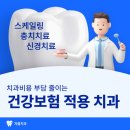 창용중학교 | “장안구 학세권 부모님 주목! 보험 적용 잘되는 파장동 자올치과에서 임플란트까지”