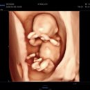 아이러브복싱 | [임신일기/10월] 웨 내 맘을 흔드는 건데? x2 (니프티 후기)