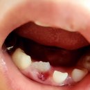 서울웃는아이소아치과의원 | [배곧 어린이 치과 : 서울웃는아이소아치과]