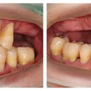 하늘치과기공소 이미지