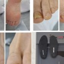 레푸스죽전새터점