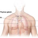 흉선종, 흉선암 및 (가슴흉통 잦은기침 호흡곤란) 이미지