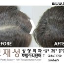 모재성성형외과의원 이미지