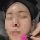 뚜레쥬르상동역점 | 부천 상동 여드름 피부관리 솔에스테틱