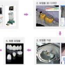 나비치과기공소 이미지