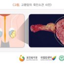 동일진단 Daum카페