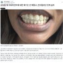 [그래피 설명회 시리즈 1편] 소비자 편 '그래피 SMA'를 선택할 수밖에 없는 이유
