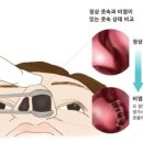 비염환자들의 공감 7가지 이미지