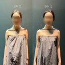 4194 | 부산 남구 신부관리 어게인바디케어 웨딩관리 웨딩케어 프로그램 후기