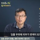 딤플 이미지