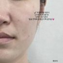 190 | 김해윤곽관리 에스페레에스테틱 12년 경력 맞춤형 작은 얼굴 관리 후기! ✨
