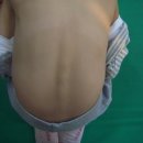 SNPE척추운동 이미지