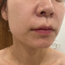 온포레 | [검단신도시 피부관리] 검단 피부관리 잘하는 곳 온포레 맞춤케어 후기