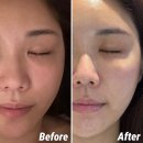 하단동피부관리실 어스제이 후기 | 글로우 리커버리 필링 관리로 맑아진 피부