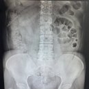 멘파워비뇨기과의원 | 여자 혈뇨로 잠실비뇨기과 요로결석 방광염 검사받은 후기