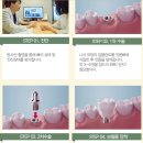 이포유#
