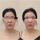 금영빌딩 | 전주피부관리 &#34;반아뷰티&#34; 작은얼굴 관리 전주완주 피부마사지관리 솔직 후기