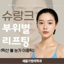 전주가정의원 | 💎 전주·완주·익산 슈링크 리프팅｜턱선·볼·눈가·이중턱 변화 실화?