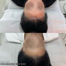 m헤어