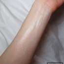 민감 트러블 피부의 디오디너리 글리코릭 애시드 각질쓱싹 토너 내돈내산 후기
