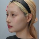 이마