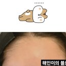 해인헤어라인