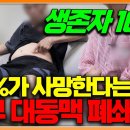 환자 절반이 수술 중 사망한다 증상이 없어 암보다 위험하다는 복부 대동맥 폐쇄증의 위험성 이미지